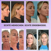 Revitaline™ – Thermisches Gesichtsmassagegerät | Erhalte Strahlend Juge Haut