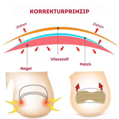 NailRescue™ - Pflegeaufkleber für Nagelkorrekturen | 50% RABATT