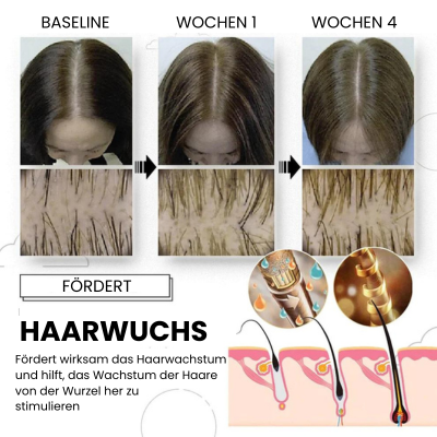 50% Rabatt | HairRejuv™ - Multifunktionale Haarwachstumskamm | Kein Haarausfall mehr!