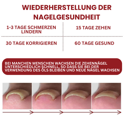 NailSoothe™ | Anti-Paronychie-Hilfsöl - 10ML (Jetzt 1+1 GRATIS)