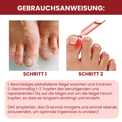 NailSoothe™ | Anti-Paronychie-Hilfsöl - 10ML (Jetzt 1+1 GRATIS)