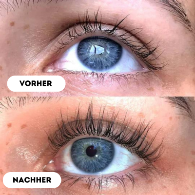 LashBoost™ - Schnelles Wimpernwachstumsserum | 50% RABATT