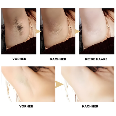 1+1 GRATIS | Luxaderm™ – Permanente Haarentfernung für Seidig Glatte Haut