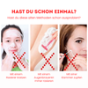 2+2 GRATIS | Epilora™ – Sanfter Haarentferner für Seidig Glatte Haut