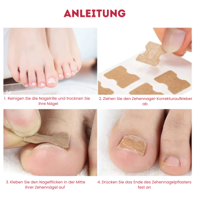 NailRescue™ - Pflegeaufkleber für Nagelkorrekturen | 50% RABATT