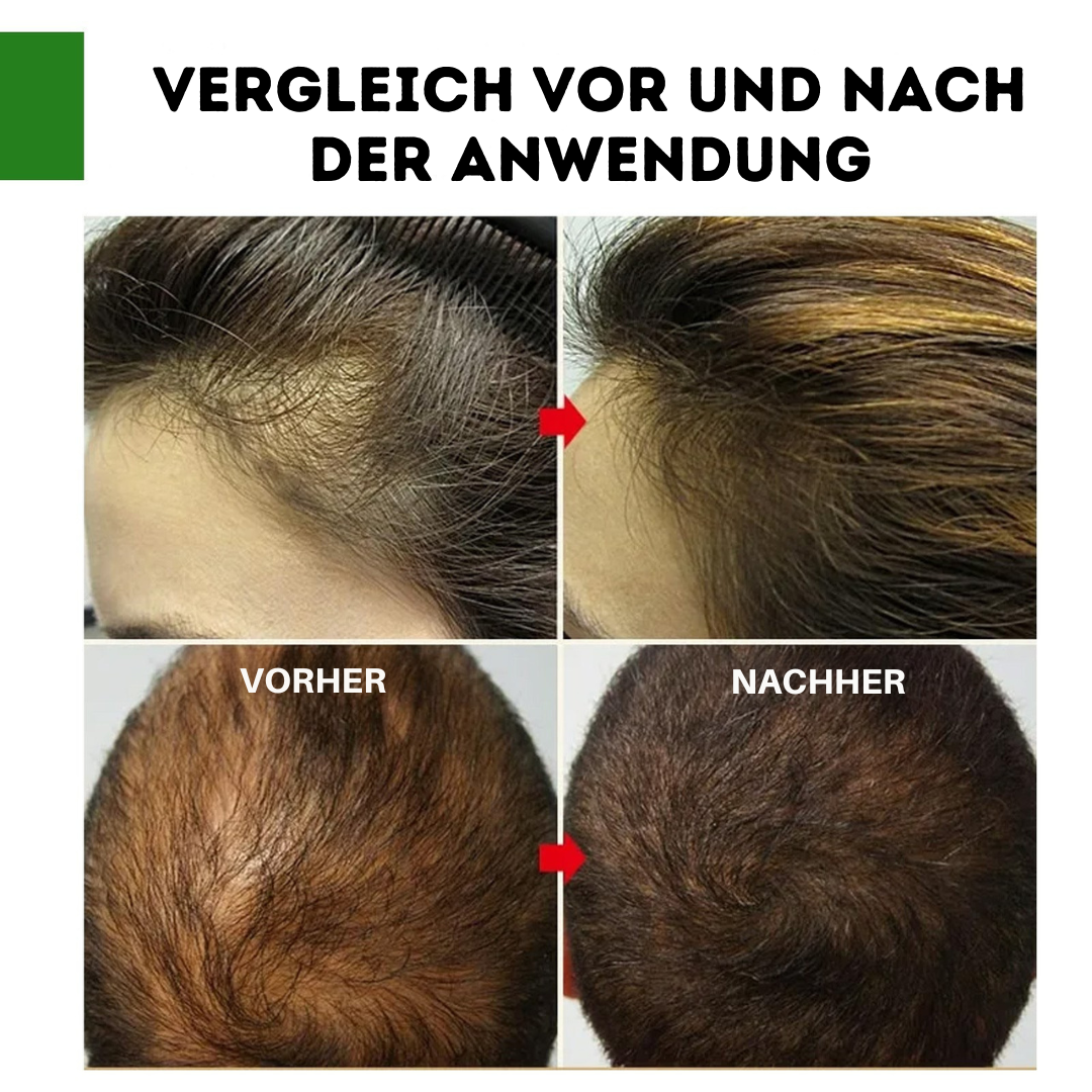 VitalBloom™ – Reines Rosmarin ätherisches Öl (Jetzt 1+1 Gratis!)