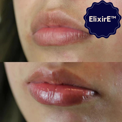 ElixirE™ - Vitamin-E-Lippenserum