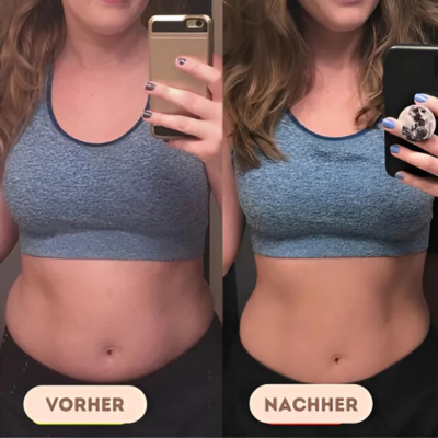 ElectroFit™ Trio | Natürlicher BBL-Trainer