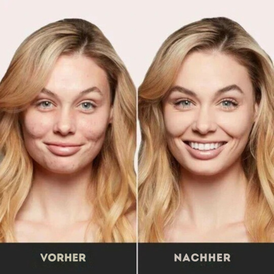 1+1 Gratis | DewAura™ - Pilzförmige Air Cushion CC Creme