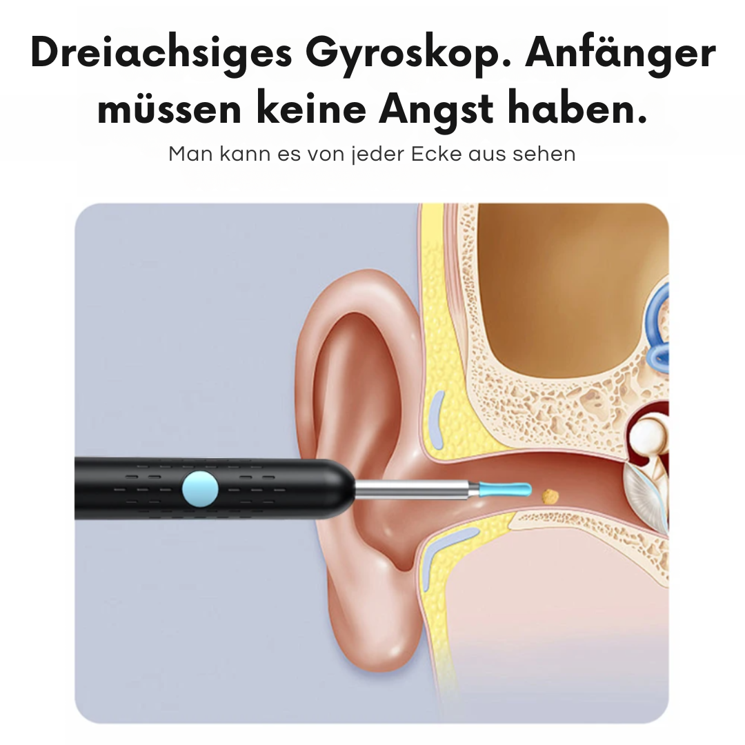 SmartEarTech™ - HD Bodenkamera Kit