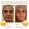 Veloria™ - Botox Faltenentfernung Creme